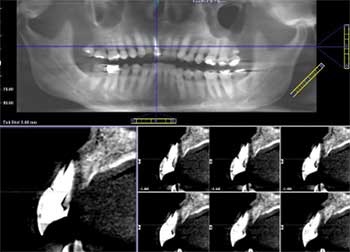 restorative dentistry, implantology, orthodontics case