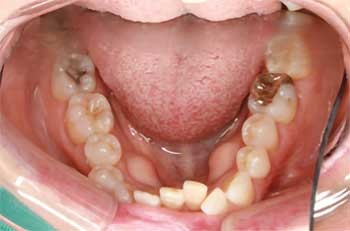 restorative dentistry, implantology, orthodontics case